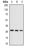 UBC6 / UBE2J2 Antibody - Western blot analysis of UBE2J2 expression in HeLa (A); mouse testis (B); mouse brain (C) whole cell lysates.