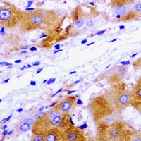 UBC6 / UBE2J2 Antibody - Immunohistochemical analysis of UBE2J2 staining in rat liver formalin fixed paraffin embedded tissue section. The section was pre-treated using heat mediated antigen retrieval with sodium citrate buffer (pH 6.0). The section was then incubated with the antibody at room temperature and detected using an HRP conjugated compact polymer system. DAB was used as the chromogen. The section was then counterstained with hematoxylin and mounted with DPX.