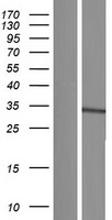 UBC6 / UBE2J2 Protein - Western validation with an anti-DDK antibody * L: Control HEK293 lysate R: Over-expression lysate