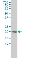 UBCH / UBE2H Antibody - UBE2H monoclonal antibody (M01), clone 3C4-1A2 Western Blot analysis of UBE2H expression in HeLa.