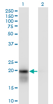 UBCH / UBE2H Antibody - Western Blot analysis of UBE2H expression in transfected 293T cell line by UBE2H monoclonal antibody (M01), clone 3C4-1A2.Lane 1: UBE2H transfected lysate(20.7 KDa).Lane 2: Non-transfected lysate.