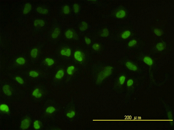 UBCH / UBE2H Antibody - Immunofluorescence of monoclonal antibody to UBE2H on HeLa cell. [antibody concentration 10 ug/ml]