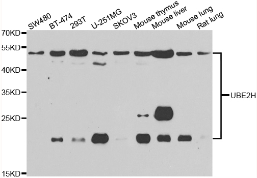 UBCH / UBE2H Antibody - Western blot analysis of extracts of various cell lines.