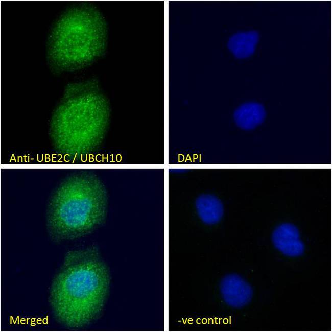UBCH10 / UBE2C Antibody - UBCH10 / UBE2C antibody immunofluorescence analysis of paraformaldehyde fixed U2OS cells, permeabilized with 0.15% Triton. Primary incubation 1hr (10ug/ml) followed by Alexa Fluor 488 secondary antibody (4ug/ml), showing cytoplasmic /Plasma Membrane staining. The nuclear stain is DAPI (blue). Negative control: Unimmunized goat IgG (10ug/ml) followed by Alexa Fluor 488 secondary antibody (4ug/ml).