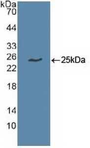 UBCH10 / UBE2C Antibody - Western Blot; Sample: Recombinant UBE2C, Human.