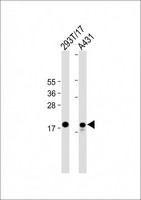 UBCH10 / UBE2C Antibody - All lanes: Anti-UBE2C Antibody (C-term) at 1:2000 dilution Lane 1: 293T/17 whole cell lysate Lane 2: A431 whole cell lysate Lysates/proteins at 20 µg per lane. Secondary Goat Anti-mouse IgG, (H+L), Peroxidase conjugated at 1/10000 dilution. Predicted band size: 20 kDa Blocking/Dilution buffer: 5% NFDM/TBST.