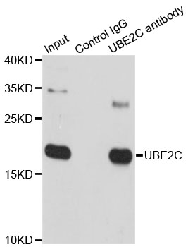 UBCH10 / UBE2C Antibody - Immunoprecipitation analysis of 150ug extracts of SW620 cells.