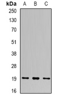 UBCH10 / UBE2C Antibody - Western blot analysis of UBE2C expression in THP1 (A); SW620 (B); SKOV3 (C) whole cell lysates.