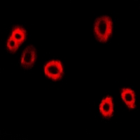 UBCH10 / UBE2C Antibody - Immunofluorescent analysis of UBE2C staining in HeLa cells. Formalin-fixed cells were permeabilized with 0.1% Triton X-100 in TBS for 5-10 minutes and blocked with 3% BSA-PBS for 30 minutes at room temperature. Cells were probed with the primary antibody in 3% BSA-PBS and incubated overnight at 4 deg C in a humidified chamber. Cells were washed with PBST and incubated with a DyLight 594-conjugated secondary antibody (red) in PBS at room temperature in the dark.