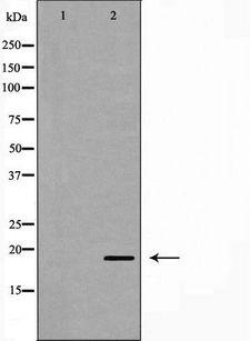 UBCH10 / UBE2C Antibody - Western blot analysis of HeLa whole cells lysates using UBE2C antibody. The lane on the left is treated with the antigen-specific peptide.