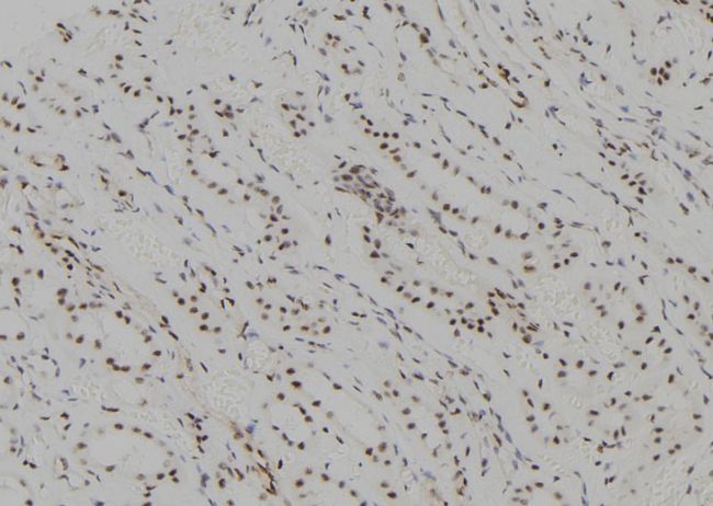 UBCH10 / UBE2C Antibody - 1:100 staining human kidney tissue by IHC-P. The sample was formaldehyde fixed and a heat mediated antigen retrieval step in citrate buffer was performed. The sample was then blocked and incubated with the antibody for 1.5 hours at 22°C. An HRP conjugated goat anti-rabbit antibody was used as the secondary.