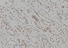 UBCH10 / UBE2C Antibody - 1:100 staining human kidney tissue by IHC-P. The sample was formaldehyde fixed and a heat mediated antigen retrieval step in citrate buffer was performed. The sample was then blocked and incubated with the antibody for 1.5 hours at 22°C. An HRP conjugated goat anti-rabbit antibody was used as the secondary.