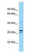 UBE1DC1 / UBA5 Antibody - UBE1DC1 / UBA5 antibody Western Blot of Mouse Thymus.  This image was taken for the unconjugated form of this product. Other forms have not been tested.