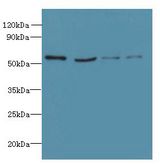 UBE1DC1 / UBA5 Antibody - Western blot. All lanes: UBA5 antibody at 6 ug/ml. Lane 1: Jurkat whole cell lysate. Lane 2: HeLa whole cell lysate. Lane 3: HepG-2 whole cell lysate. Lane 4: Caco-2 whole cell lysate. Secondary antibody: Goat polyclonal to Rabbit IgG at 1:10000 dilution. Predicted band size: 45 kDa. Observed band size: 45 kDa.