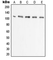 UBE1L / UBA7 Antibody - Western blot analysis of UBA7 expression in Raji (A); HL60 (B); HeLa (C); THP1 (D); A549 (E) whole cell lysates.