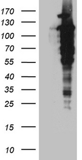 UBE1L / UBA7 Antibody - HEK293T cells were transfected with the pCMV6-ENTRY control. (Left lane) or pCMV6-ENTRY UBA7. (Right lane) cDNA for 48 hrs and lysed
