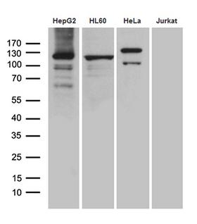 UBE1L / UBA7 Antibody - Western blot analysis of extracts. (35ug) from 4 cell lines by using anti-UBA7 monoclonal antibody. (1:500)