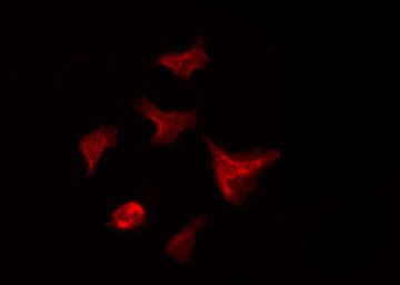 UBE1L / UBA7 Antibody - Staining HeLa cells by IF/ICC. The samples were fixed with PFA and permeabilized in 0.1% Triton X-100, then blocked in 10% serum for 45 min at 25°C. The primary antibody was diluted at 1:200 and incubated with the sample for 1 hour at 37°C. An Alexa Fluor 594 conjugated goat anti-rabbit IgG (H+L) Ab, diluted at 1/600, was used as the secondary antibody.
