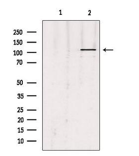 UBE1L / UBA7 Antibody - Western blot analysis of extracts of HepG2 cells using UBE1L antibody. Lane 1 was treated with the blocking peptide.