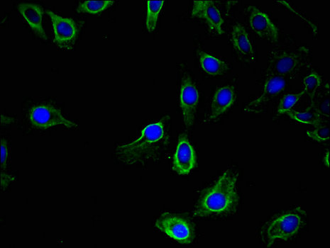 UBE1L2 / UBE1L2 Antibody - Immunofluorescent analysis of Hela cells using UBA6 Antibody at a dilution of 1:100 and Alexa Fluor 488-congugated AffiniPure Goat Anti-Rabbit IgG(H+L)