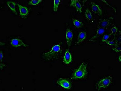 UBE1L2 / UBE1L2 Antibody - Immunofluorescent analysis of Hela cells using UBA6 Antibody at dilution of 1:100 and Alexa Fluor 488-congugated AffiniPure Goat Anti-Rabbit IgG(H+L)