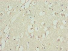 UBE1L2 / UBE1L2 Antibody - Immunohistochemistry of paraffin-embedded human brain tissue at dilution 1:100