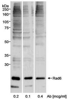 UBE2A Antibody - Detection of Human Rad6 by Western Blot. Samples: Whole cell lysate (50 ug) from 293T cells. Antibody: Affinity purified rabbit anti-Rad6 antibody used at the indicated concentrations. Detection: Chemiluminescence.