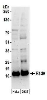 UBE2A Antibody - Detection of human Rad6 by western blot. Samples: Whole cell lysate (50 µg) from HeLa and HEK293T cells prepared using NETN lysis buffer. Antibody: Affinity purified rabbit anti-Rad6 antibody used for WB at 0.4 µg/ml. Detection: Chemiluminescence with an exposure time of 3 minutes.