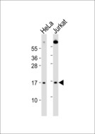 UBE2A Antibody - All lanes : Anti-UBE2A/B Antibody at 1:1000 dilution Lane 1: HeLa whole cell lysates Lane 2: Jurkat whole cell lysates Lysates/proteins at 20 ug per lane. Secondary Goat Anti-Rabbit IgG, (H+L),Peroxidase conjugated at 1/10000 dilution Predicted band size : 17 kDa Blocking/Dilution buffer: 5% NFDM/TBST.