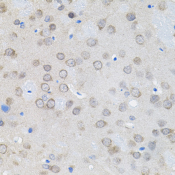 UBE2A Antibody - Immunohistochemistry of paraffin-embedded rat brain tissue.