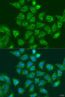 UBE2A Antibody - Immunofluorescence analysis of U2OS cells using UBE2A antibody at dilution of 1:100. Blue: DAPI for nuclear staining.