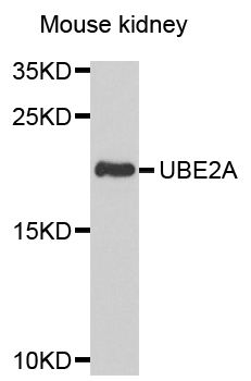 UBE2A Antibody - Western blot analysis of extracts of mouse kidney, using UBE2A antibody at 1:1000 dilution. The secondary antibody used was an HRP Goat Anti-Rabbit IgG (H+L) at 1:10000 dilution. Lysates were loaded 25ug per lane and 3% nonfat dry milk in TBST was used for blocking. An ECL Kit was used for detection and the exposure time was 90s.