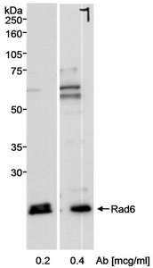UBE2A Antibody - Detection of Human Rad6 by Western Blot. Samples: Whole cell lysate (50 ug) from 293T cells. Antibody: Affinity purified rabbit anti-Rad6 antibody used at the indicated concentrations. Detection: Chemiluminescence.