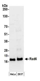 UBE2A Antibody - Detection of human Rad6 by western blot. Samples: Whole cell lysate (50 µg) from HeLa and HEK293T cells prepared using NETN lysis buffer. Antibody: Affinity purified rabbit anti-Rad6 antibody used for WB at 0.04 µg/ml. Detection: Chemiluminescence with an exposure time of 30 seconds.