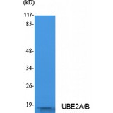 UBE2A+B Antibody - Western blot of UBE2A/B antibody