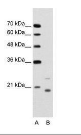 UBE2D1 / UBCH5 Antibody - A: Marker, B: Jurkat Cell Lysate.  This image was taken for the unconjugated form of this product. Other forms have not been tested.