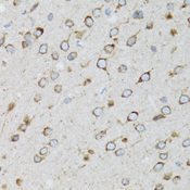 UBE2D1 / UBCH5 Antibody - Immunohistochemistry of paraffin-embedded rat brain tissue.