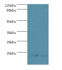 UBE2D1 / UBCH5 Antibody - Western blot. All lanes: Ubiquitin-conjugating enzyme E2 D1 antibody at 2 ug/ml. Lane 1: HeLa whole cell lysate Lane 2: NIH3T3 whole cell lysate. Secondary antibody: goat polyclonal to rabbit at 1:10000 dilution. Predicted band size: 17 kDa. Observed band size: 17 kDa.  This image was taken for the unconjugated form of this product. Other forms have not been tested.