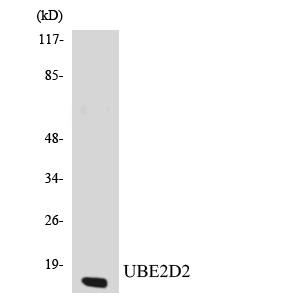 UBE2D2 / UBCH5B Antibody - Western blot analysis of the lysates from K562 cells using UBE2D2 antibody.