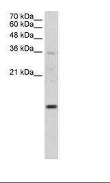 UBE2D2 / UBCH5B Antibody - Jurkat Cell Lysate.  This image was taken for the unconjugated form of this product. Other forms have not been tested.