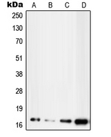 UBE2D2 / UBCH5B Antibody - Western blot analysis of UBE2D2 expression in MCF7 (A); HepG2 (B); NIH3T3 (C); H9C2 (D) whole cell lysates.
