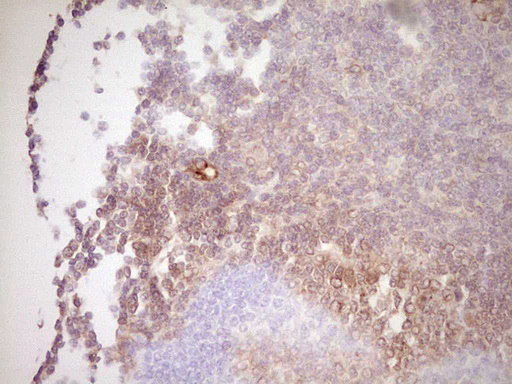 UBE2D2 / UBCH5B Antibody - Immunohistochemical staining of paraffin-embedded Human tonsil within the normal limits using anti-UBE2D2 mouse monoclonal antibody. (Heat-induced epitope retrieval by 1 mM EDTA in 10mM Tris, pH8.5, 120C for 3min,