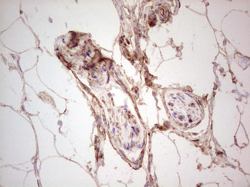UBE2D2 / UBCH5B Antibody - Immunohistochemical staining of paraffin-embedded Human bladder tissue within the normal limits using anti-UBE2D2 mouse monoclonal antibody. (Heat-induced epitope retrieval by 1 mM EDTA in 10mM Tris, pH8.5, 120C for 3min,