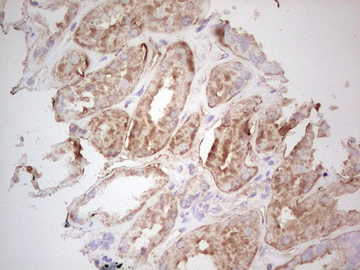 UBE2D2 / UBCH5B Antibody - Immunohistochemical staining of paraffin-embedded Human Kidney tissue within the normal limits using anti-UBE2D2 mouse monoclonal antibody. (Heat-induced epitope retrieval by 1 mM EDTA in 10mM Tris, pH8.5, 120C for 3min,