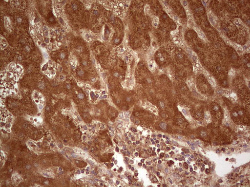 UBE2D2 / UBCH5B Antibody - IHC of paraffin-embedded Human liver tissue using anti-UBE2D2 mouse monoclonal antibody. (Heat-induced epitope retrieval by 1 mM EDTA in 10mM Tris, pH8.5, 120°C for 3min).