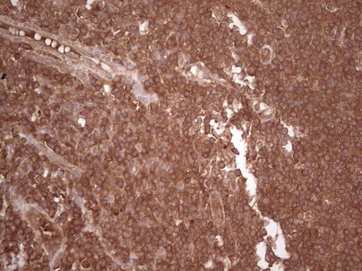 UBE2D2 / UBCH5B Antibody - IHC of paraffin-embedded Human tonsil using anti-UBE2D2 mouse monoclonal antibody. (Heat-induced epitope retrieval by 1 mM EDTA in 10mM Tris, pH8.5, 120°C for 3min).