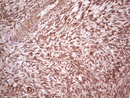 UBE2D2 / UBCH5B Antibody - Immunohistochemical staining of paraffin-embedded Human Ovary tissue within the normal limits using anti-UBE2D2 mouse monoclonal antibody. (Heat-induced epitope retrieval by 1 mM EDTA in 10mM Tris, pH8.5, 120C for 3min,