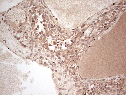 UBE2D2 / UBCH5B Antibody - Immunohistochemical staining of paraffin-embedded Human lymph node tissue within the normal limits using anti-UBE2D2 mouse monoclonal antibody. (Heat-induced epitope retrieval by 1 mM EDTA in 10mM Tris, pH8.5, 120C for 3min,