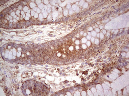 UBE2D2 / UBCH5B Antibody - Immunohistochemical staining of paraffin-embedded Human colon tissue within the normal limits using anti-UBE2D2 mouse monoclonal antibody. (Heat-induced epitope retrieval by 1 mM EDTA in 10mM Tris, pH8.5, 120C for 3min,