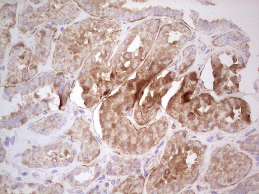 UBE2D2 / UBCH5B Antibody - Immunohistochemical staining of paraffin-embedded Human Kidney tissue within the normal limits using anti-UBE2D2 mouse monoclonal antibody. (Heat-induced epitope retrieval by 1 mM EDTA in 10mM Tris, pH8.5, 120C for 3min,
